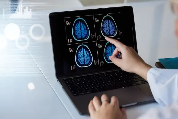 enfermedades neurodegenerativas